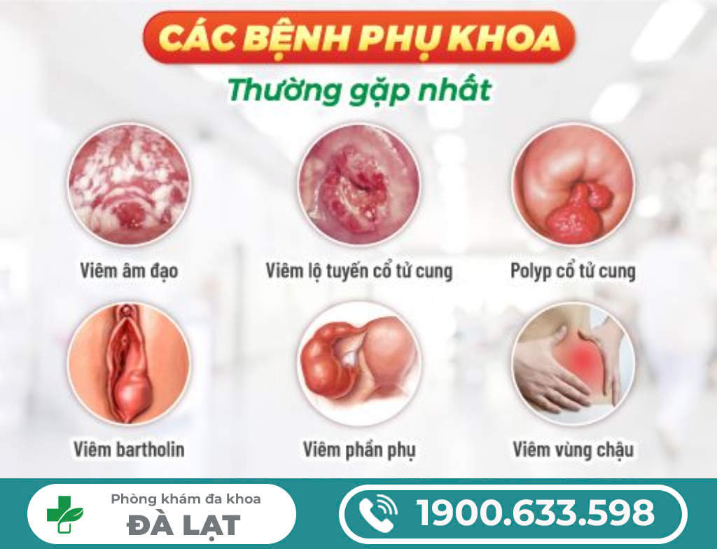 Hình ảnh minh họa